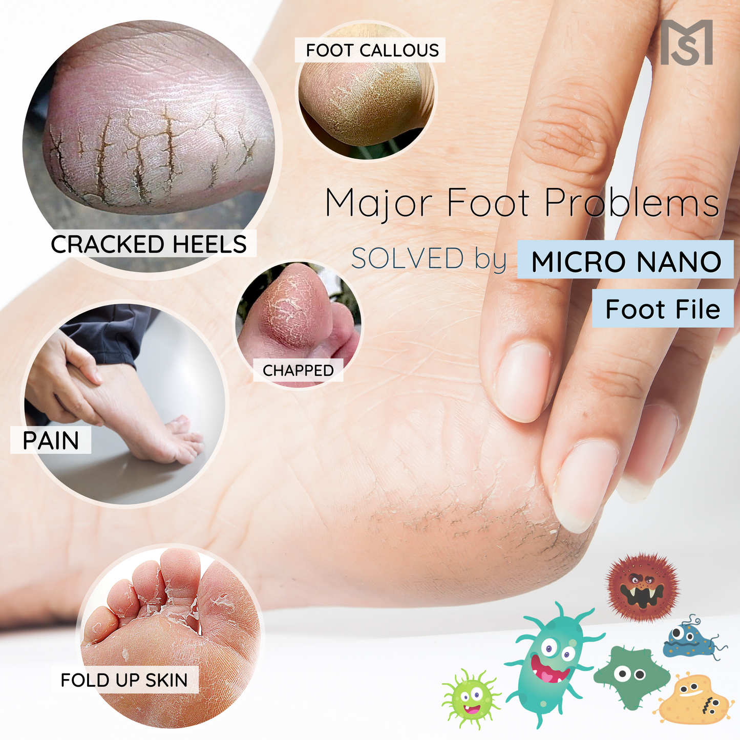 Micro Foot File
