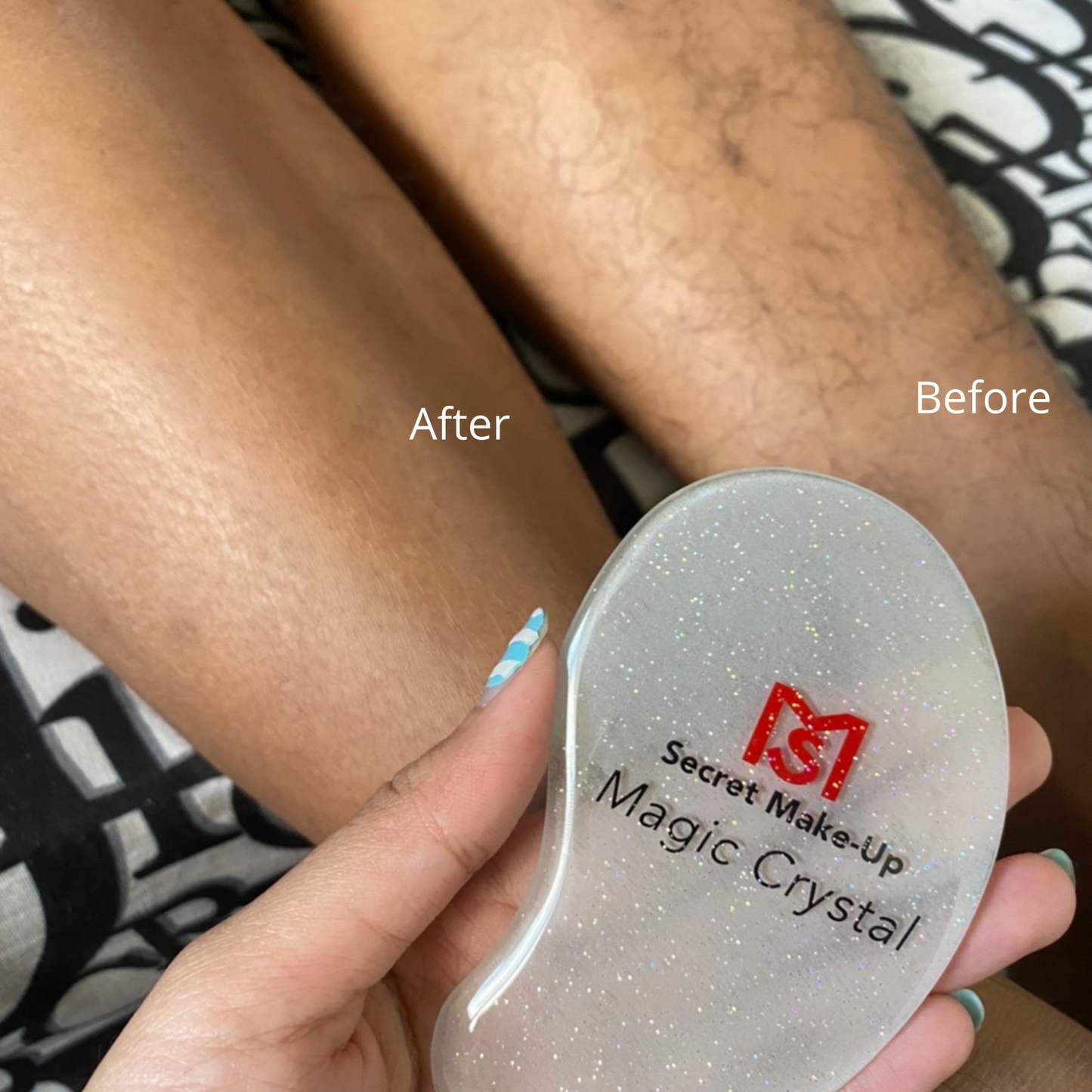 Magic Crystal® Hair Remover
